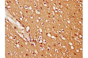 IHC image of ABIN7173447 diluted at 1:200 and staining in paraffin-embedded human brain tissue performed on a Leica BondTM system. (TRIM45 antibody  (AA 428-573))
