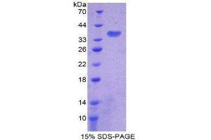 SDS-PAGE (SDS) image for ATPase, H+ Transporting, Lysosomal Accessory Protein 2 (ATP6AP2) (AA 18-302) protein (His tag) (ABIN2124091) (ATP6AP2 Protein (AA 18-302) (His tag))