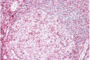 Immunohistochemistry (IHC) image for anti-Major Histocompatibility Complex, Class I, B (HLA-B) (Internal Region) antibody (ABIN5539556)