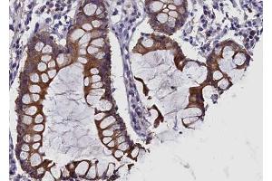 ABIN6269120 at 1/100 staining human colon tissue sections by IHC-P. (c-MET antibody  (Internal Region))