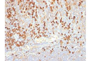 Formalin-fixed, paraffin-embedded human Tonsil stained with Plasma Cell Marker Monoclonal Antibody (LIV3G11). (Plasma Cell Marker antibody)