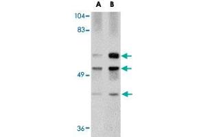 Western blot analysis of GALNT10 in rat brain tissue lysate with GALNT10 polyclonal antibody  at (A) 1 and (B) 2 ug/mL .