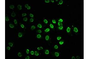 Immunofluorescence (IF) image for anti-Histone H2B (acLys20) antibody (ABIN7139170)