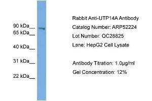 WB Suggested Anti-UTP14A  Antibody Titration: 0. (UTP14A antibody  (N-Term))