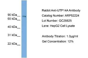 WB Suggested Anti-UTP14A  Antibody Titration: 0.
