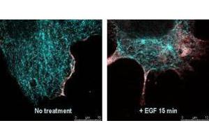 Immunofluorescence (IF) image for Goat anti-Rabbit IgG antibody (DyLight 488) (ABIN6699123)