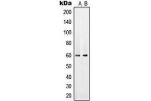 Western blot analysis of PAHT expression in HeLa (A), mouse brain (B) whole cell lysates. (SLC22A6 antibody  (Center))