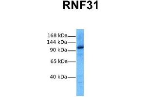 Host:  Rabbit  Target Name:  RNF31  Sample Tissue:  Human MCF7  Antibody Dilution:  1. (RNF31 antibody  (Middle Region))