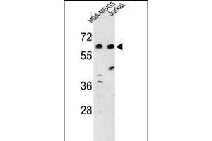 Western blot analysis of C19orf26 Antibody (Center) (ABIN653222 and ABIN2842757) in MDA-M, Jurkat cell line lysates (35 μg/lane). (C19orf26 antibody  (AA 423-450))