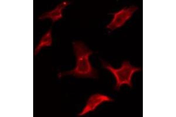 S1PR2 antibody  (Internal Region)