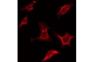ABIN6275933 staining COLO205 by IF/ICC. (S1PR2 antibody  (Internal Region))