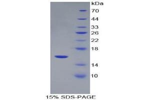 SDS-PAGE (SDS) image for Renin (REN) (AA 67-153) protein (His tag) (ABIN2126660) (Renin Protein (REN) (AA 67-153) (His tag))