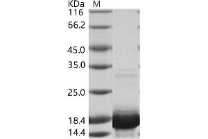 Western Blotting (WB) image for Dengue Virus 2 Capsid (DENV2 C) protein (His tag) (ABIN7198894)