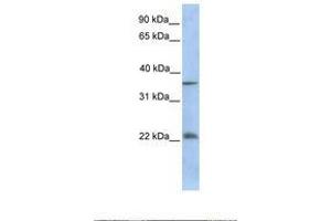 Image no. 1 for anti-RING1 and YY1 Binding Protein (RYBP) (C-Term) antibody (ABIN6737863) (RYBP antibody  (C-Term))