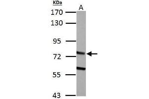 WB Image HADHA antibody detects HADHA protein by Western blot analysis. (HADHA antibody  (C-Term))
