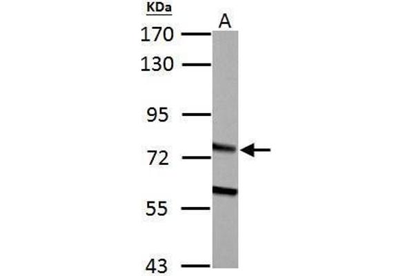 HADHA anticorps  (C-Term)