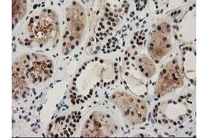 Immunohistochemical staining of paraffin-embedded Human Kidney tissue using anti-NHEJ1 mouse monoclonal antibody. (NHEJ1 antibody)