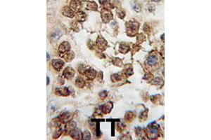 Formalin-fixed and paraffin-embedded human testis tissue reacted with NANOG polyclonal antibody  , which was peroxidase-conjugated to the secondary antibody, followed by DAB staining. (Nanog antibody  (Internal Region))