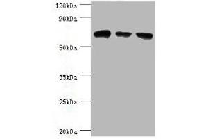 Western blot All lanes: HSPA2 antibody at 6 μg/mL Lane 1: A431 whole cell lysate Lane 2: Hela whole cell lysate Lane 3: Rat brain tissue Secondary Goat polyclonal to rabbit IgG at 1/10000 dilution Predicted band size: 70 kDa Observed band size: 70 kDa (HSPA2 antibody  (AA 400-639))