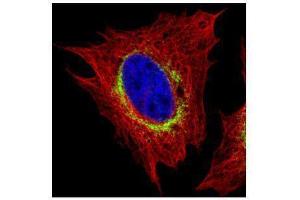 ICC/IF Image Confocal immunofluorescence analysis (Olympus FV10i) of paraformaldehyde-fixed HeLa, using Ribosome binding protein 1, antibody (Green) at 1:500 dilution. (RRBP1 antibody  (C-Term))