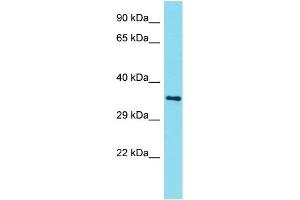 Host: Rabbit Target Name: AMMECR1L Sample Type: NCI-H226 Whole Cell lysates Antibody Dilution: 1. (AMMECR1-Like antibody  (N-Term))