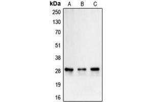 Western blot analysis of Carbonic Anhydrase 2 expression in Caco2 (A), K562 (B), Caki1 (C) whole cell lysates. (CA2 antibody  (C-Term))