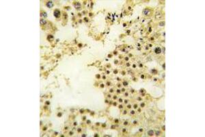 Image no. 1 for anti-Zinc Finger Protein 219 (ZNF219) (N-Term) antibody (ABIN357352)
