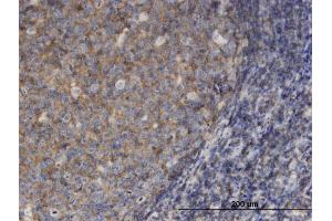 Immunoperoxidase of monoclonal antibody to MSN on formalin-fixed paraffin-embedded human tonsil. (Moesin antibody  (AA 422-531))