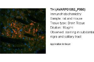 Image no. 3 for anti-TH (N-Term) antibody (ABIN2792118) (TH antibody  (N-Term))