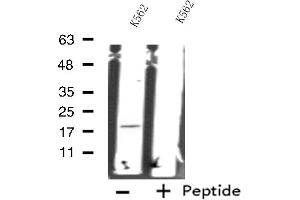 Western blot analysis of extracts from K562 cells, using RPS18 antibody.