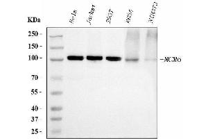 Western blot analysis of MCM6 using anti-MCM6 antibody (ABIN7600037).