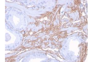 Formalin-fixed, paraffin-embedded human Prostate stained with Decorin Mouse Monoclonal Antibody (DCN/3523). (Decorin antibody  (AA 212-336))