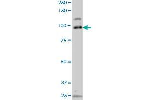 SRPK1 monoclonal antibody (M10A), clone 4G12 Western Blot analysis of SRPK1 expression in Jurkat . (SRPK1 antibody  (AA 371-470))