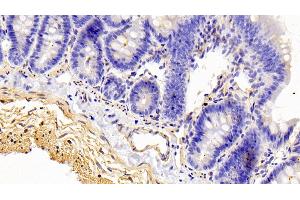 Detection of CALD in Rat Colon Tissue using Polyclonal Antibody to Caldesmon (CALD) (Caldesmon antibody  (AA 434-531))