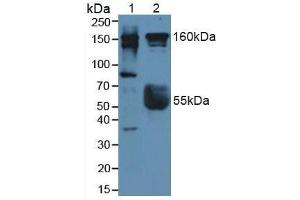 Figure. (ROCK2 antibody  (AA 904-1140))