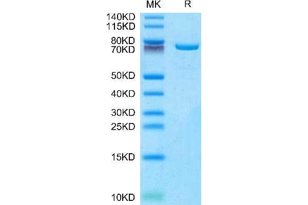 Transglutaminase 2 Protein (AA 2-686) (His tag)