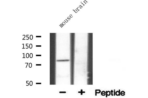 CDKN2AIP antibody  (Internal Region)