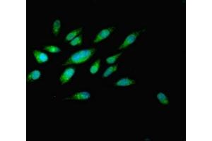 Immunofluorescent analysis of Hela cells using ABIN7162519 at dilution of 1:100 and Alexa Fluor 488-congugated AffiniPure Goat Anti-Rabbit IgG(H+L) (PILRB antibody  (AA 20-191))