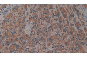 Immunohistochemistry (IHC) image for anti-alpha-2-Glycoprotein 1, Zinc-Binding (AZGP1) (AA 148-298) antibody (ABIN7438511)