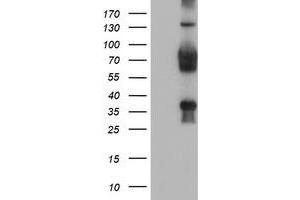 HEK293T cells were transfected with the pCMV6-ENTRY control (Left lane) or pCMV6-ENTRY TLE2 (Right lane) cDNA for 48 hrs and lysed. (TLE2 antibody)