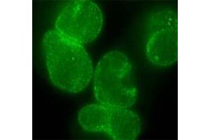 Immunofluorescent staining of HeLa cells with Nup153 monoclonal antibody, clone R4C8 .
