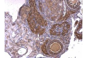 Immunohistochemistry (IHC) image for anti-Guanine Nucleotide Binding Protein (G Protein), Q Polypeptide (GNAQ) (Center) antibody (ABIN2855848)