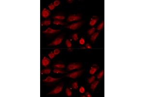 Immunofluorescence analysis of U20S cell using TP53BP1 antibody. (TP53BP1 antibody)