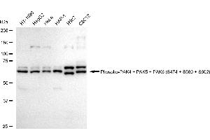 Western blotting analysis using Phospho-PAK4 + PAK5 + PAK6 (S474 + S560 + S602) antibody (ABIN7799729).