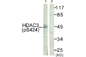 Immunohistochemistry analysis of paraffin-embedded human skin tissue using HDAC3 (Phospho-Ser424) antibody.
