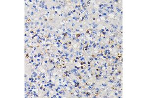 Immunohistochemistry of paraffin-embedded human spleen using CD11a/LFA-1A/ITGAL Rabbit mAb (ABIN7267923) at dilution of 1:100 (40x lens). (ITGAL antibody)