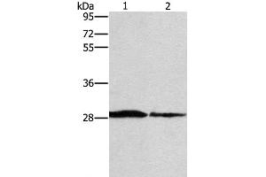 Western Blot analysis of Human chromaffin cell tumor tissue and lovo cell using SPR Polyclonal Antibody at dilution of 1:1500 (SPR antibody)