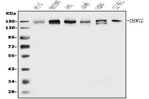 Western blot analysis of EHMT2/G9A using anti-EHMT2/G9A antibody (ABIN7602084).