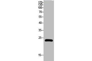 Western Blot analysis of HELA cells using Claudin-5 Polyclonal Antibody (Claudin 5 antibody  (C-Term))