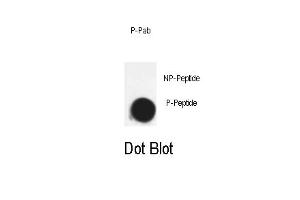 Dot blot analysis of Phospho-Cdk7- Pab (ABIN389541 and ABIN2850443) on nitrocellulose membrane.